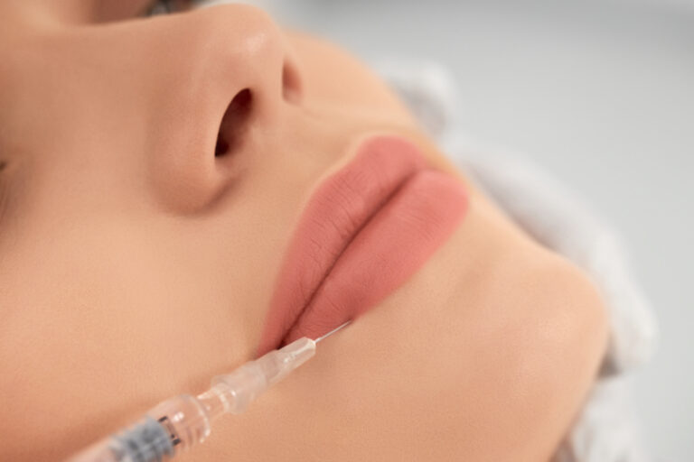 filler labbra milano