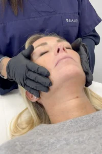 peeling viso a cosa serve