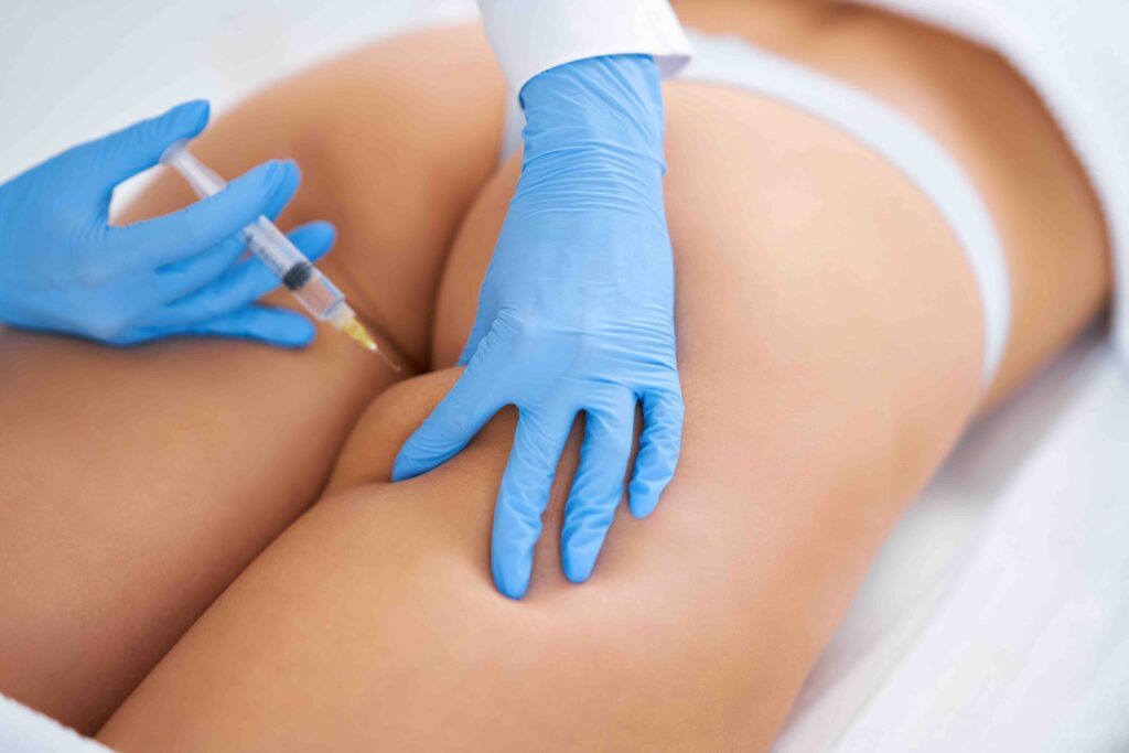 Medicina estetica prima dell'estate