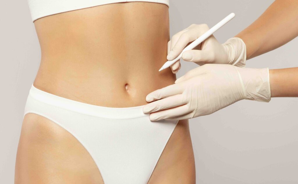 Intralipoterapia a Milano