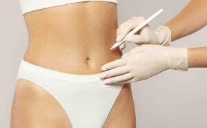 Intralipoterapia a Milano