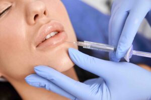 come togliere filler labbra